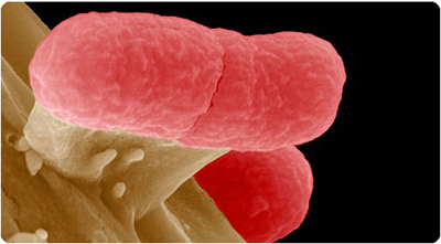 EHEC-bakteeri. Kuva: Manfred Rohde/Scanpix.