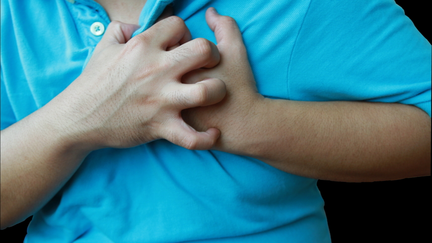 Sydänkohtauksen yleisimpiä oireita ovat rintakipu, säteilevä kipu käsivarsissa sekä hengenahdistus.