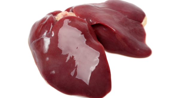 Maksasolusyöpä (hepatosellulaarinen karsinooma)