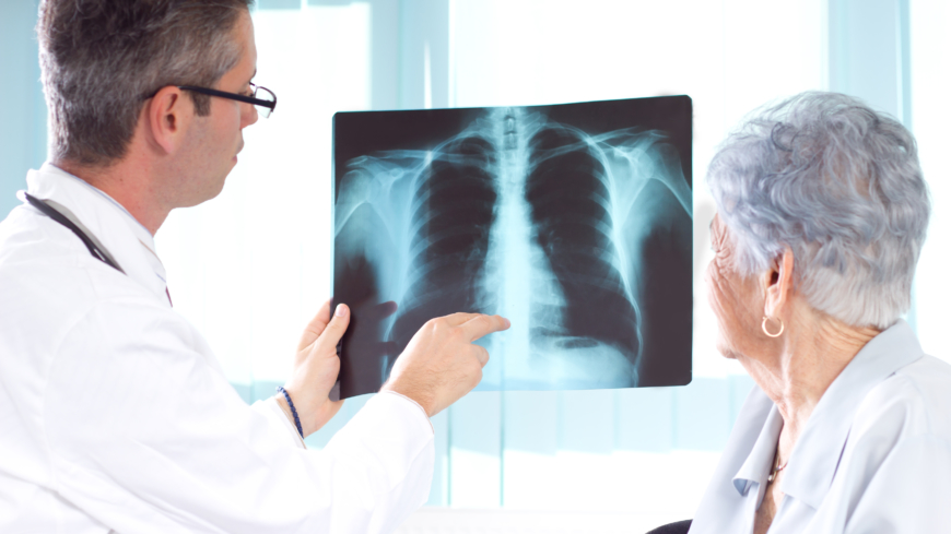 Tuberkuloosi on lähinnä keuhkoihin vaikuttava tartuntatauti.