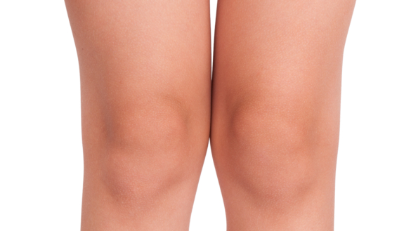 Schlatterin polvi (Schlatterin tauti)