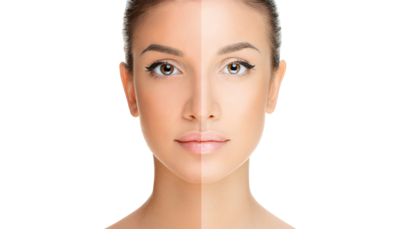 Borderline eli rajatilahäiriö