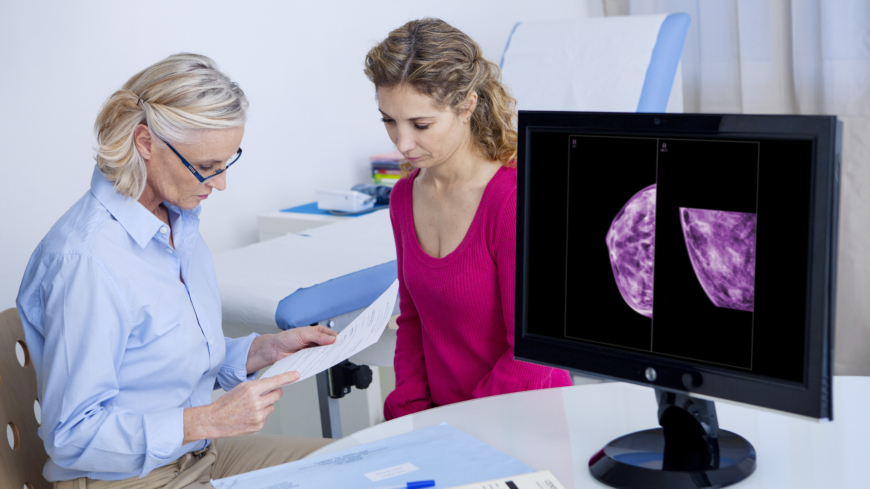Noin 30 prosenttia kaikista naisten syövistä on rintasyöpiä. Rintasyöpään sairastuvien mediaani-ikä on hieman yli 65 vuotta. Kuva: Shutterstock