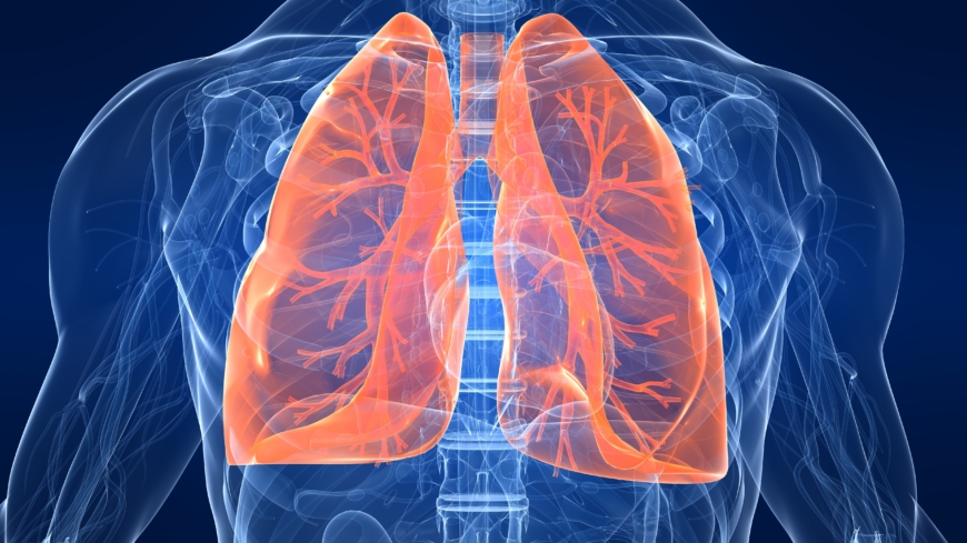 Keuhkofibroosin diagnosointi on ”salapoliisityötä” ja se tehdään poissulkemismenetelmällä.  Kuva: Shutterstock